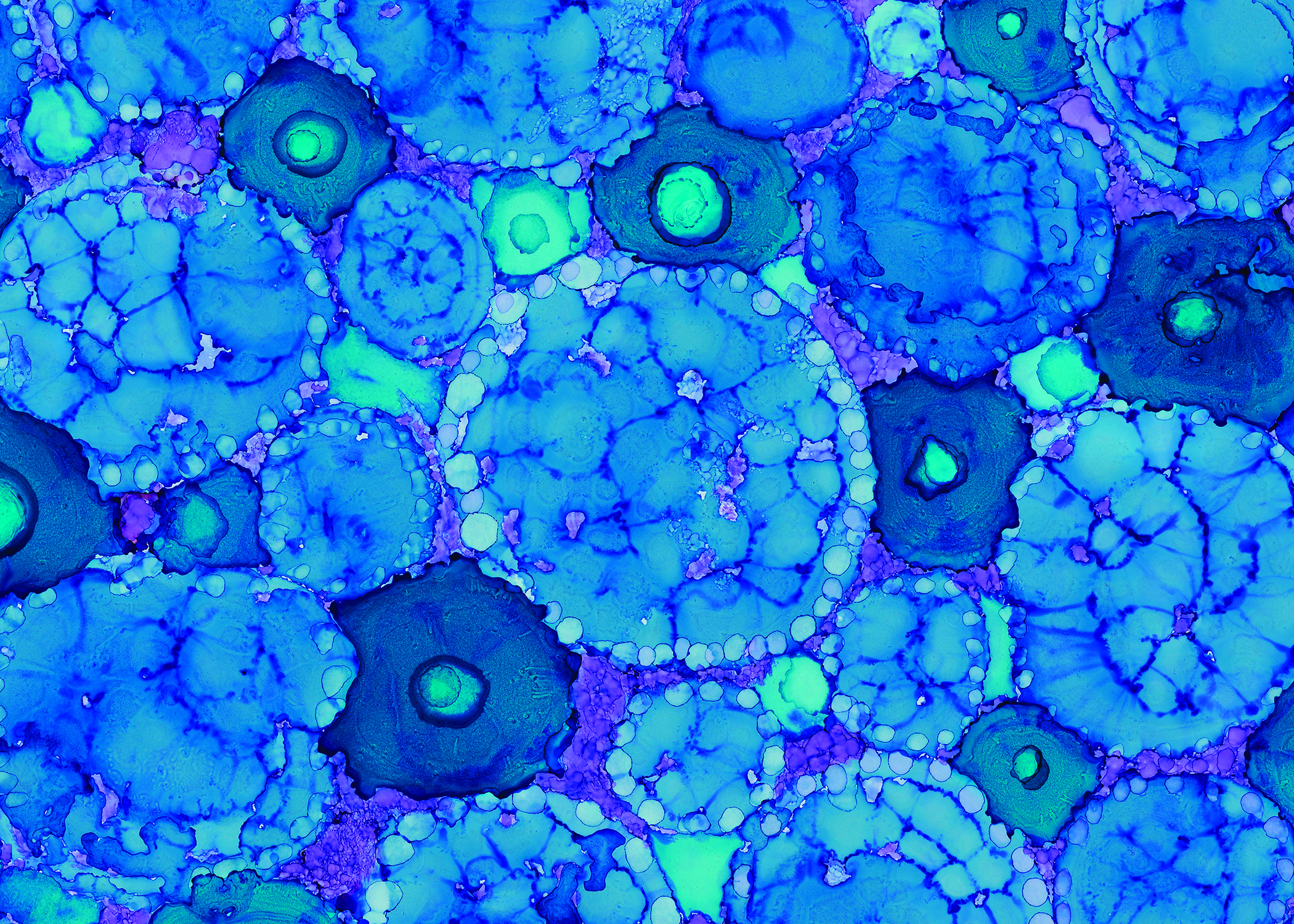 Een nieuwe kijk op type 1 diabetes: het immuunsysteem opnieuw in balans brengen